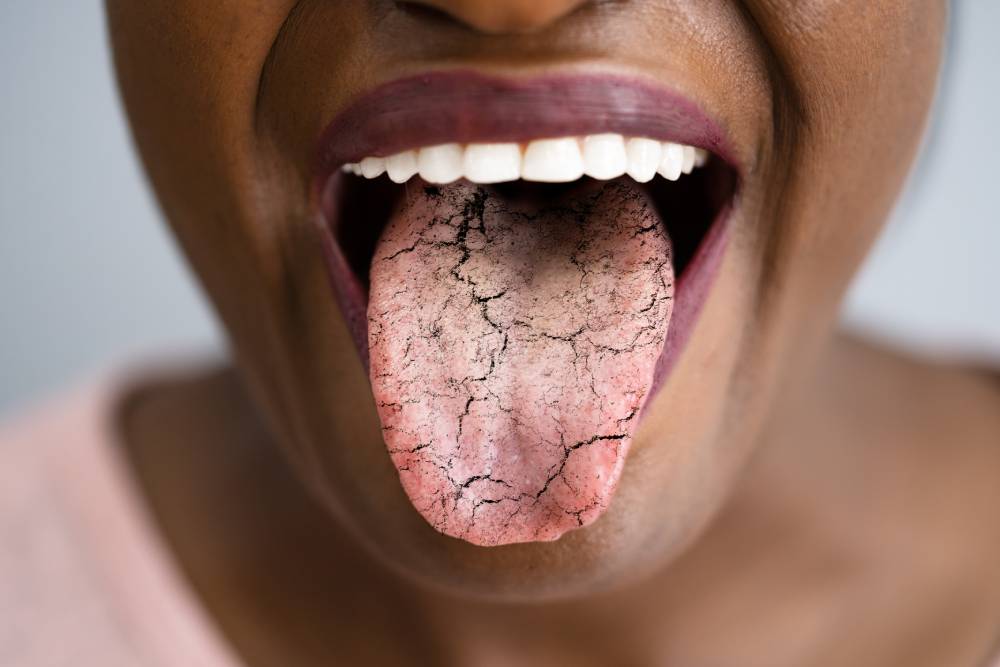 Awareness: Why Is Dry Mouth Dangerous?